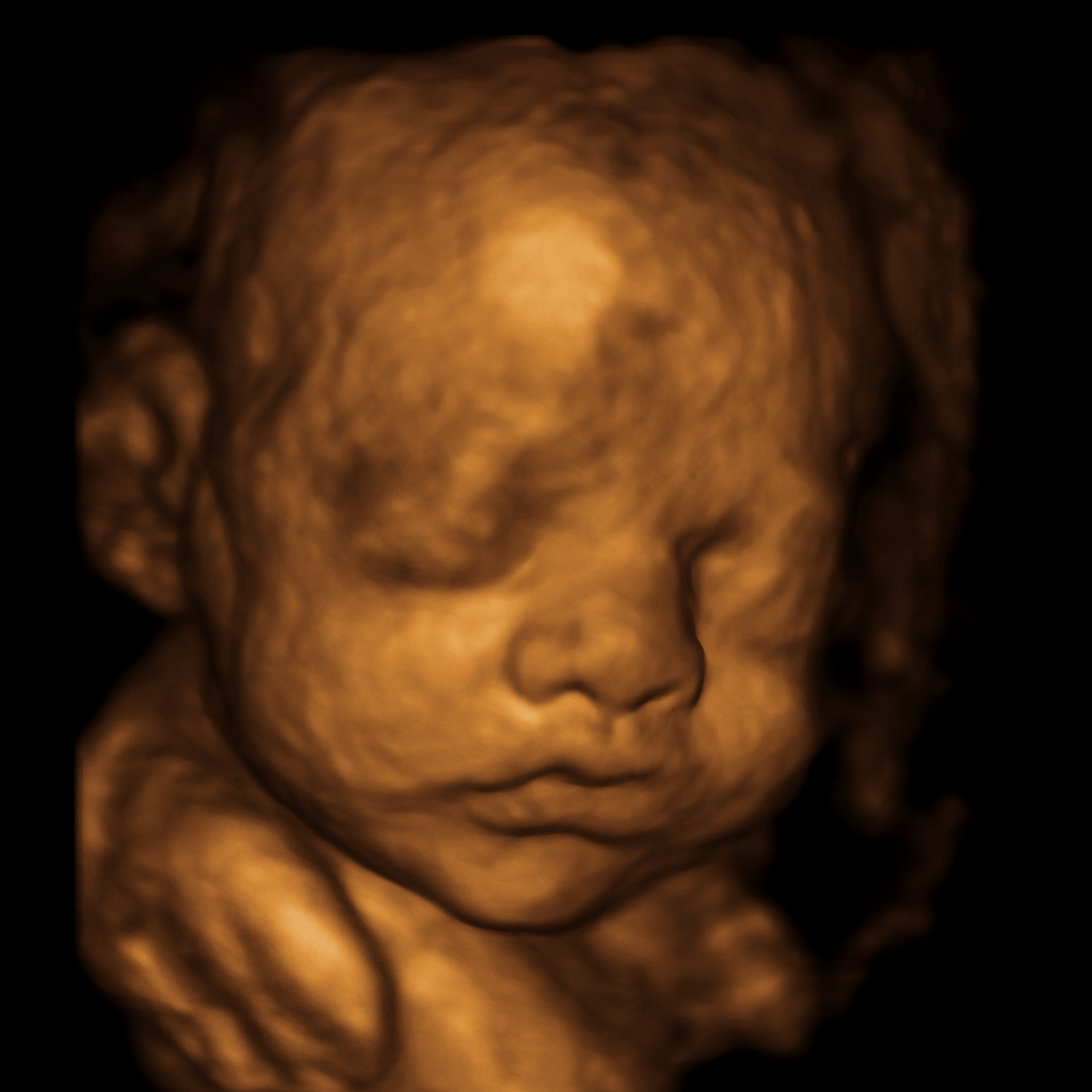 3D süßes Ultraschallbild personalisiert – mit Namen, Datum & Schwangerschaftswoche